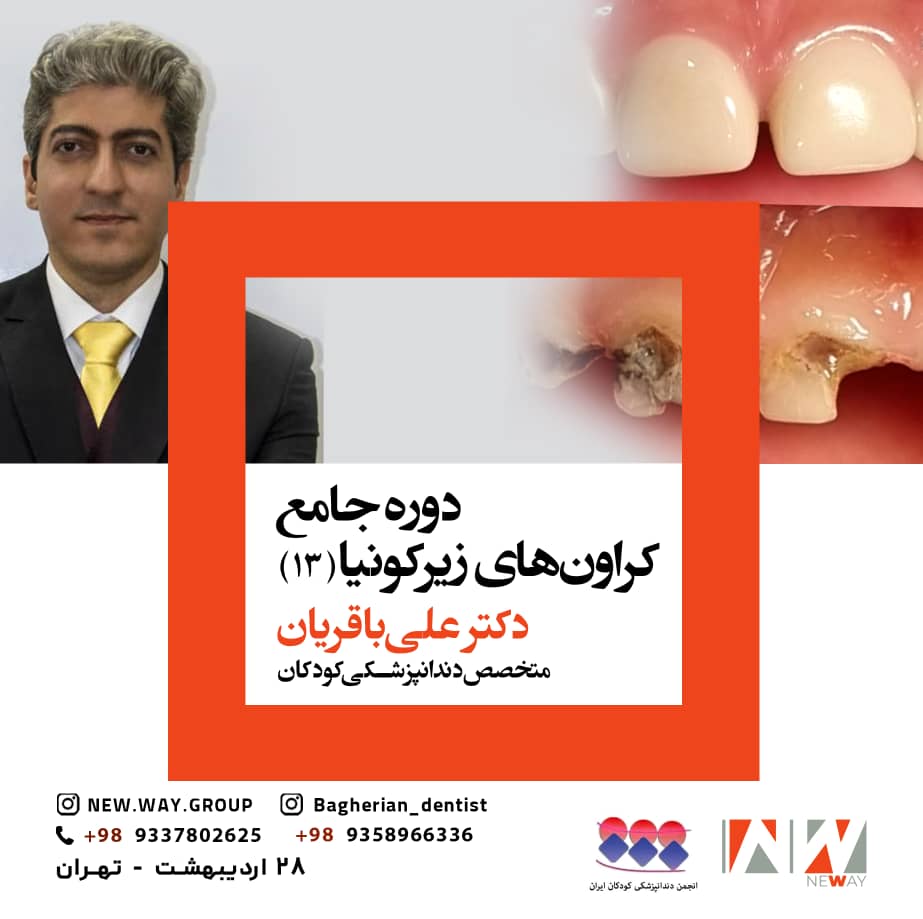 <p>سیزدهمین دوره جامع کرونهای زیرکونیا&nbsp;</p>